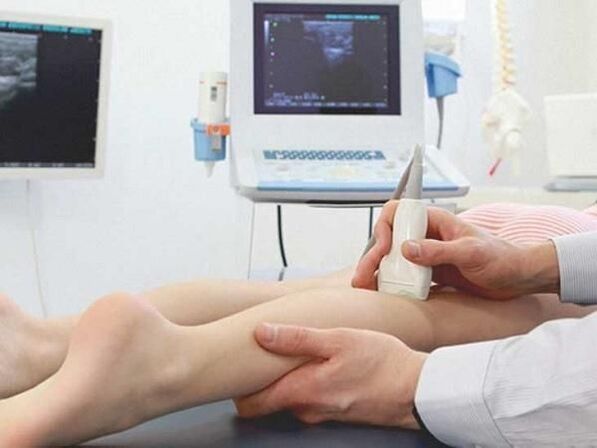 ultrasound of the veins of the lower extremities