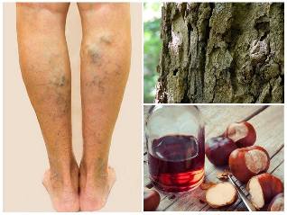 the line of treatment on legs folk remedies