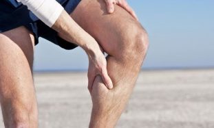 varicose veins in the legs in men
